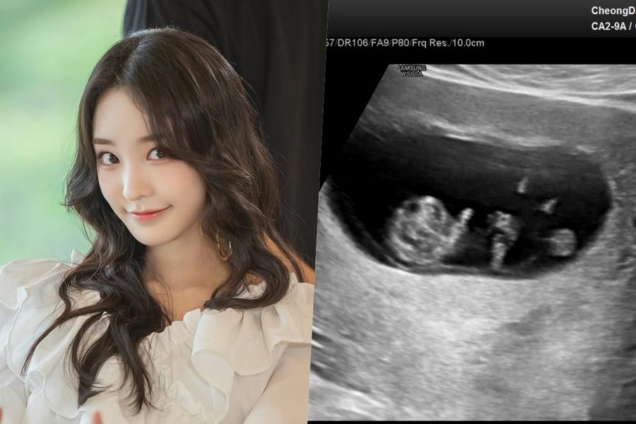 sonamoos-nahyun-revela-gravidez-e-casamento-veja-os-detalhes